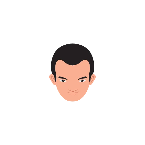 Hair Loss Type 4