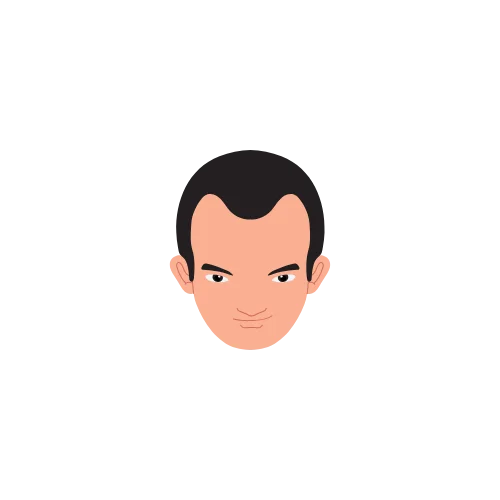 Hair Loss Type 9