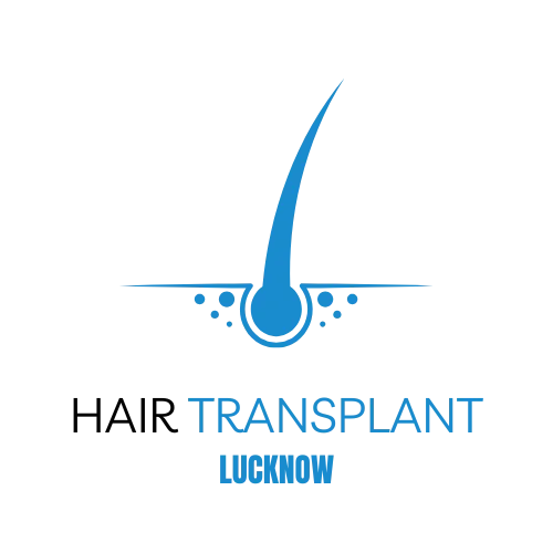 Hair Transplant Lucknow