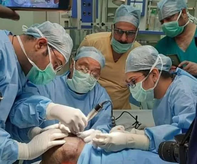 Hair Transplant Cost in KGMU Lucknow
