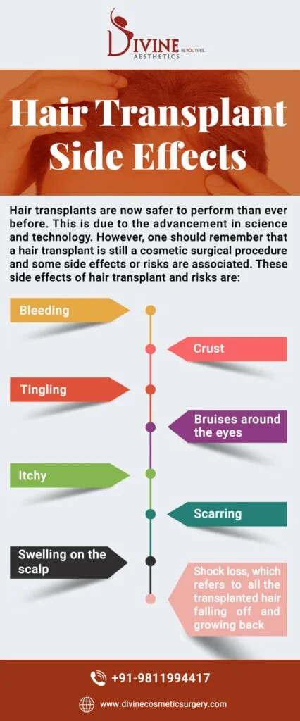 Hair Transplant Side Effects 426X1024