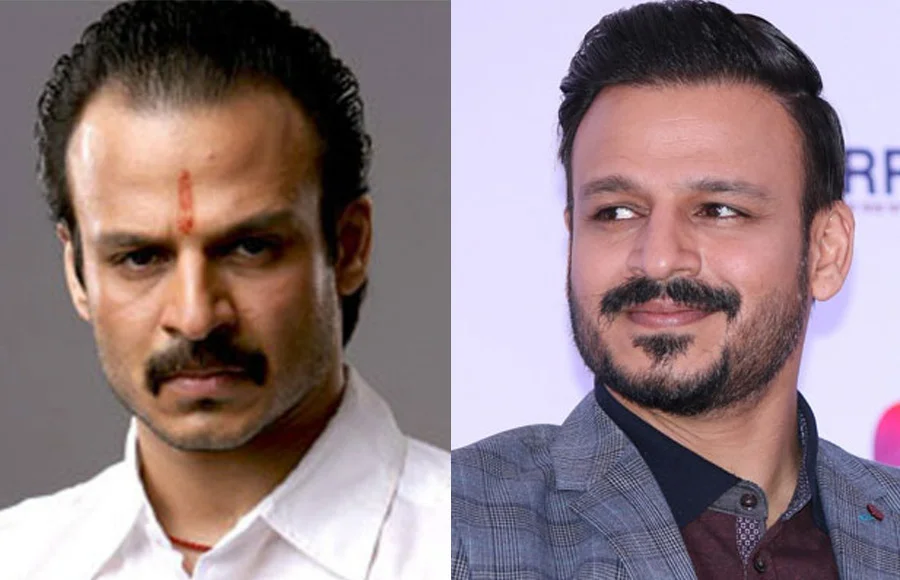 Vivek Oberoi Hair Transplant
